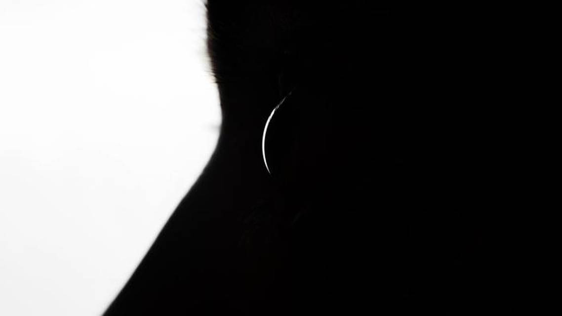 I Had Cataract Surgery and Heres What Happened