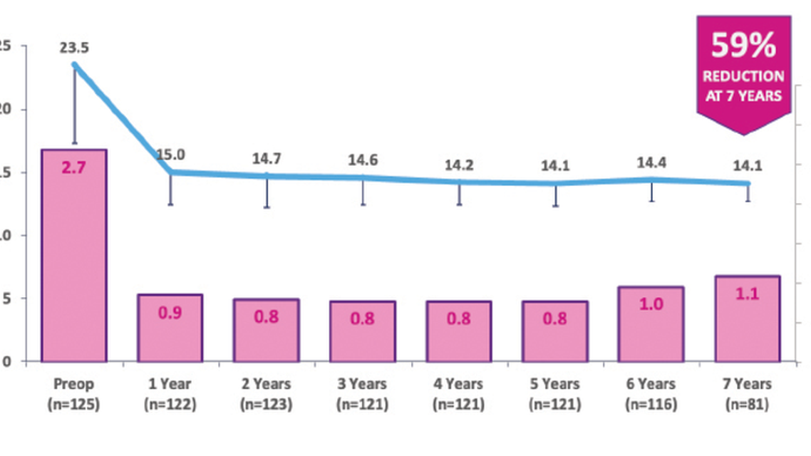 Long Term Evidence With iStent inject