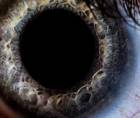 Case Studies in Pupil Dilation