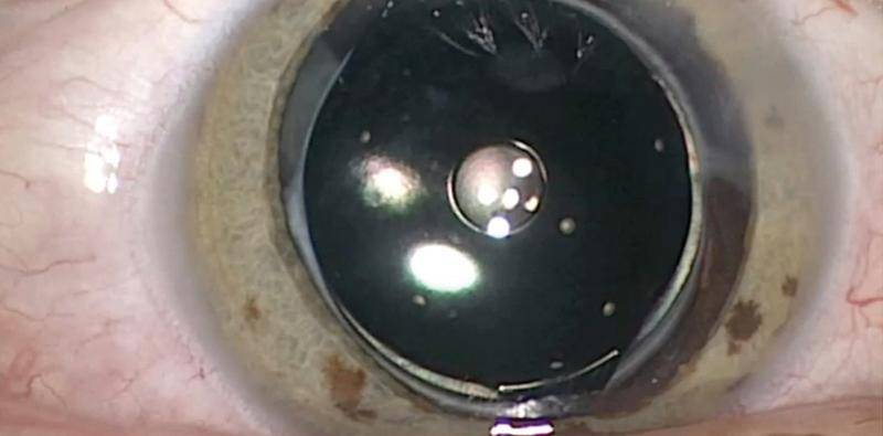 Small Aperture Optics An Old Principle Made New