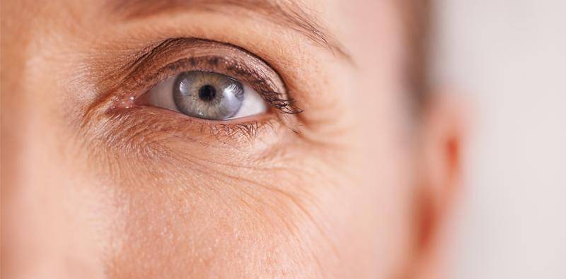 Pressure Induced Stromal Keratitis