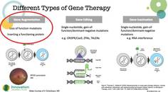Gene Therapy for the Retina