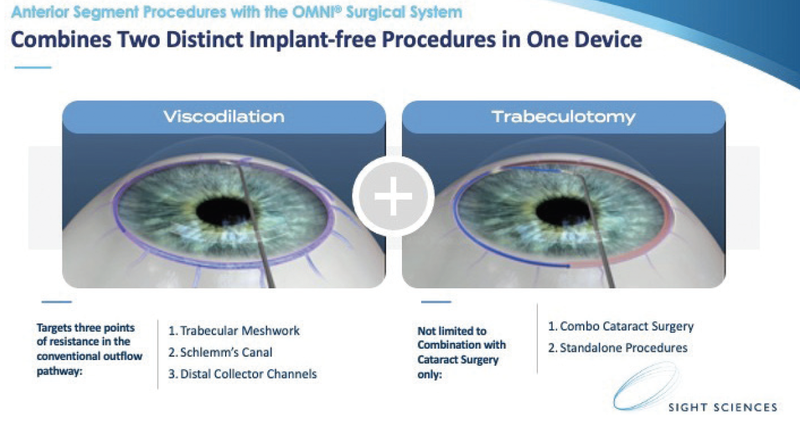 Surgery of the Conventional Outflow Pathway
