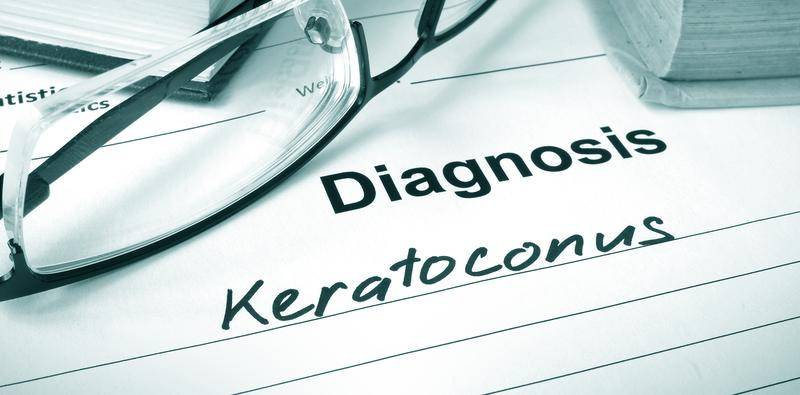 Fluctuating Vision After Radial Keratotomy