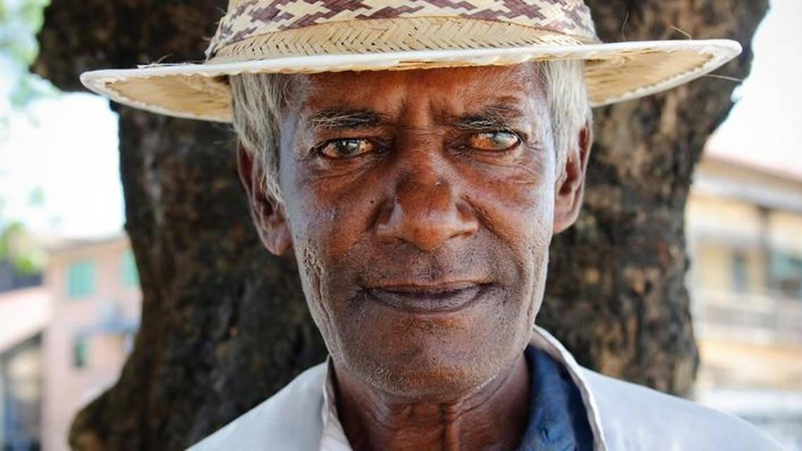 Global Cataract Blindness Our Responsibility and Our Opportunity